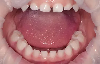 Отделение детской стоматологии - 1